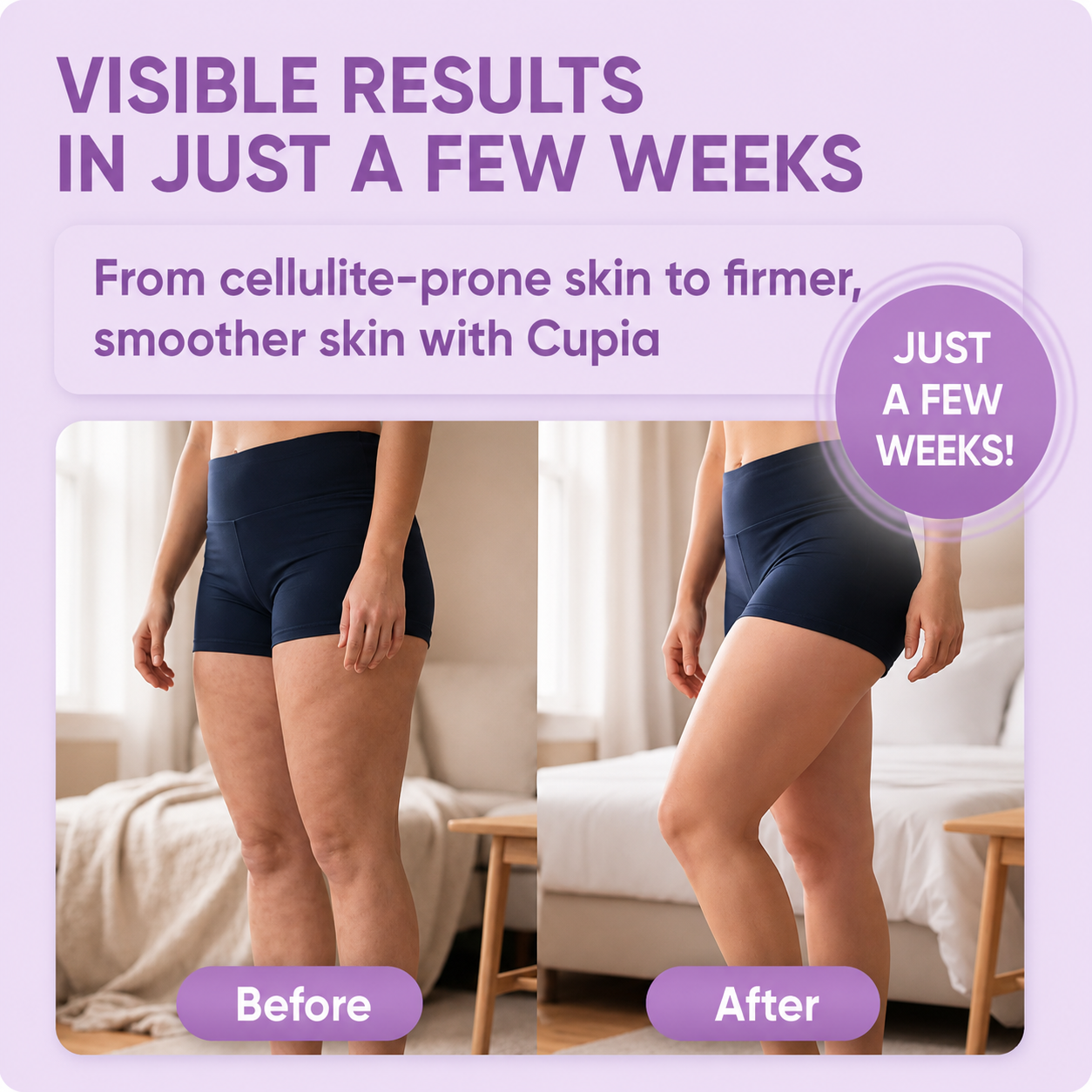 CUPIA™ Anti-Cellulite Massager